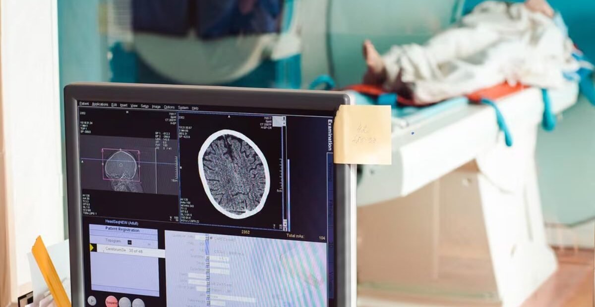 Albertans Can Pay for MRIs and Other Tests Without a Doctor’s Referral Starting Friday